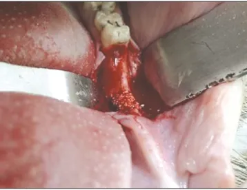 Fig. 1. After autogenous tooth grafting material augmentation.