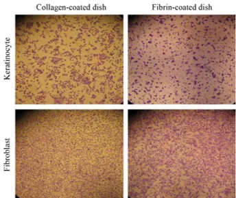 Fig. 1. Photographs of keratinocytes and fibroblast grown on colla- colla-gen-coated culture dish and fibrin-coated culture dish