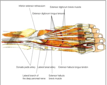 Fig. 1. Basic  anatomy  of  the  arteries  and  muscles  of  the dorsalis pedis artery flap.