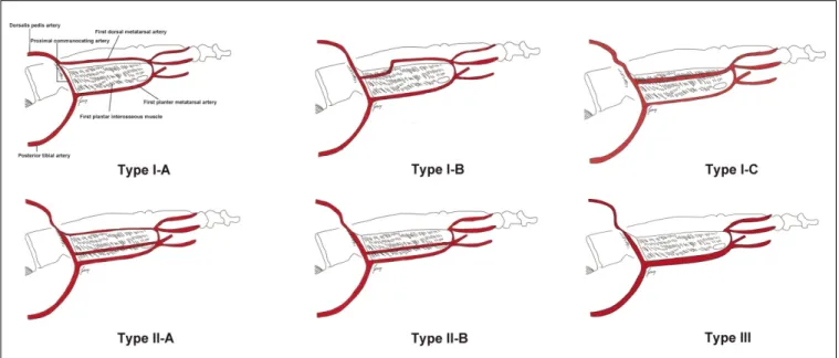 Fig. 4. Schematic drawings of various patterns of the FDMA according to the positional relationship between the FDMA and the FDIM