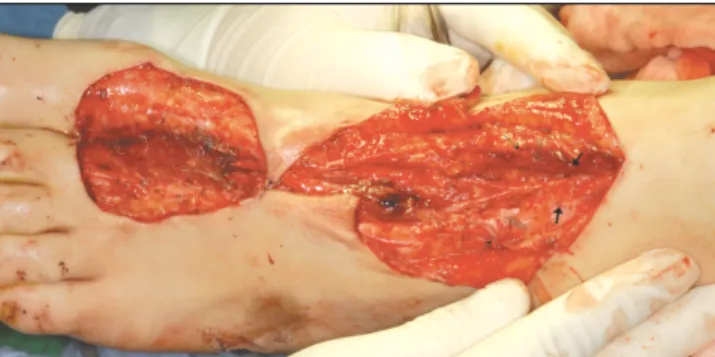 Fig. 9. Cutaneous nerves and veins of the dorsum of left foot. 