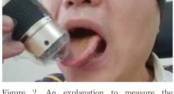 Figure 2. An explanation to measure the tongue surface.