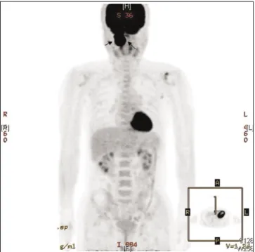 Fig. 9. Mass removal and reconstruction using RFFF.