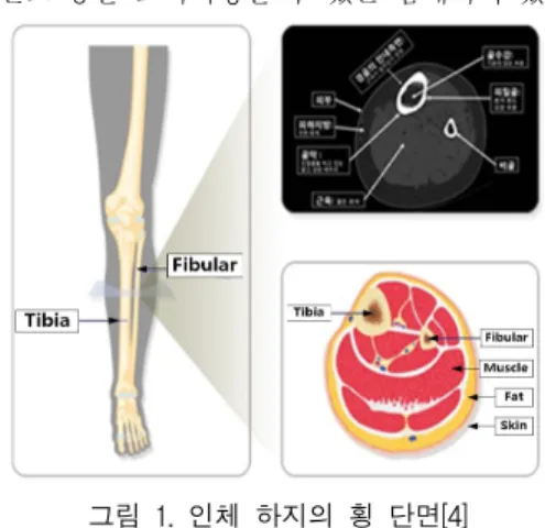 Fig.  1  Transverse  cross-section  of  human  lower  leg[4]