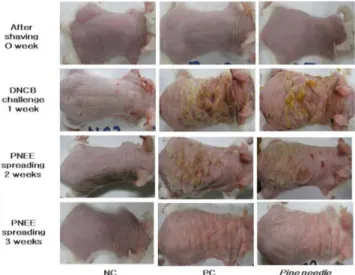 Fig. 9. Effects of pine needle ethanol extracts in atopic dermatitis- dermatitis-like skin lesions mice