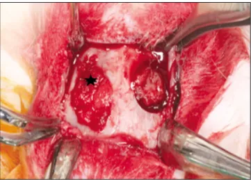 Fig. 2. The silk protein mixed with PRF was grafted into the right  parietal  bone  (experimental  group:  asterisk)  and  the left side (control group) was grafted only PRF