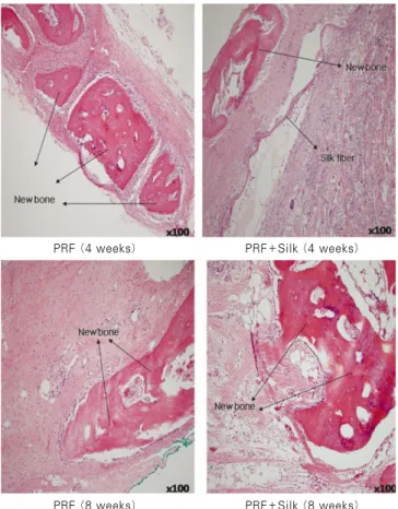 Fig. 4. Histologic section (H&amp;E staining, original magnifica- magnifica-tion  ×100)