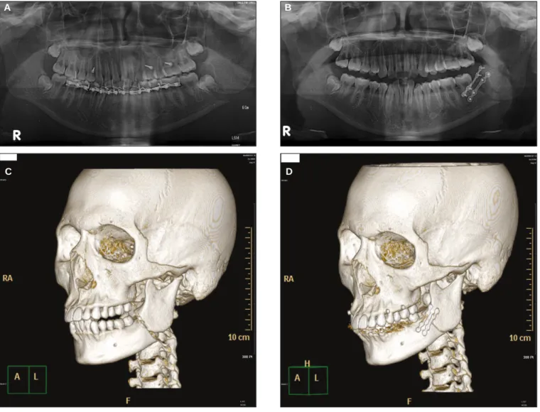 Fig. 2. Radiograph of case 3. 