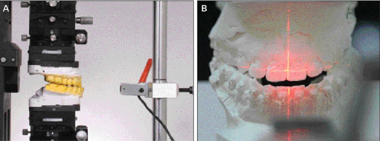 Fig. 5. A. Lateral view of mounted casts and laser beam; B. Laser beam on the cast. Vertical line is the mid-sagittal, horizontal line is equal to upper lip line.