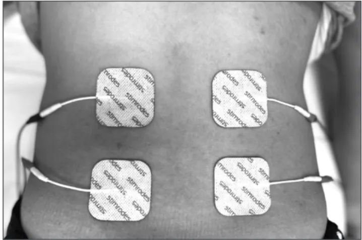 Fig. 2.  Electrodes are placed in the lumbar region.