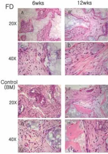 Fig. 5. Representative  histological  section  by  in  vivo  trans- trans-planted fibrous dysplasia (FD) cells and normal bone  mar-row (BM) stromal cells in immunocompromised mice,  har-vested at 6, 12 weeks