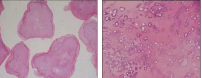 Fig. 4. hyaline cartilage and calcification in microscopic view (H-E stain. ×20 , ×200 original magnification)