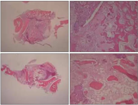 Fig. 3. Microscopic finding of bone graft area after 1week.