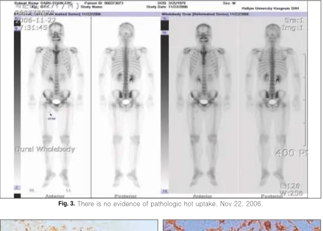 Fig. 3. There is no evidence of pathologic hot uptake. Nov 22. 2006.