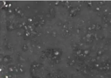 Fig. 4. Immunohistochemical  stain  of  CD43  shows  diffuse positive reaction in the cell membrane (X200).