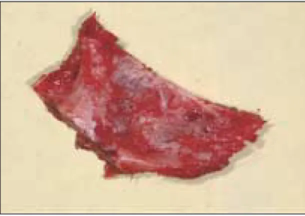Fig. 5. Immunohistochemical  Staining  For CD34  Of  Control  Group  (×200):  Some  of