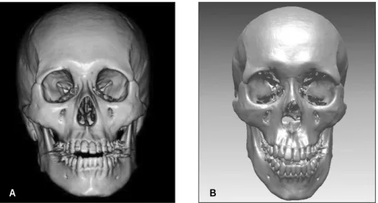 Fig. 3. Digital dental models created by a laser scanner. A and C, Maxilla. : B and D, Mandible