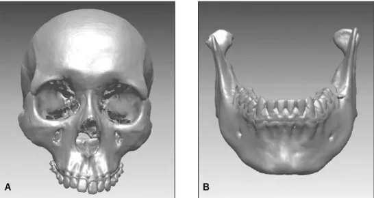 Fig. 7. The final composite images by the fusion process of the digital dental model and 3D skull model