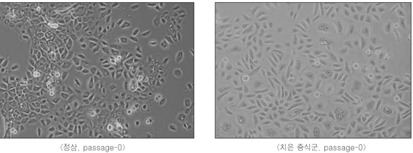 Fig. 1. Gingival  keratinocytes  were  obtained  by  incubating  from  the  normal  and  overgrown  gingival  tissues.