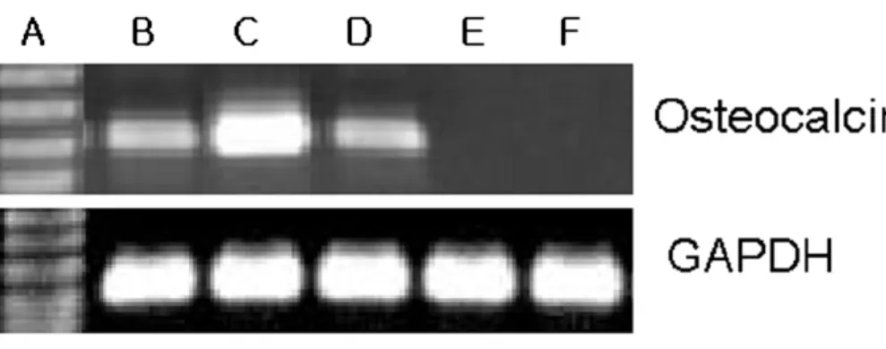 Fig. 4. Osteocalcine expression of buccal fat pad derived cells after treatment with BMP-2 for 21days.