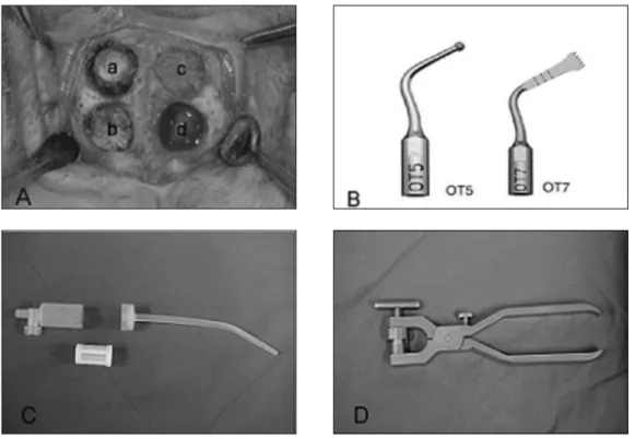 Fig. 1. (A) Defect preparation (a : Group 1, b : Group 2, c : Group 3, d : Control)  (B) Piezosurgery tip OT 5 &amp; OT 7 
