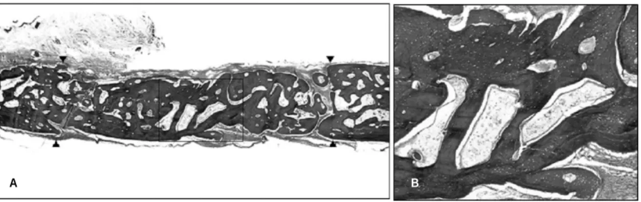 Fig. 3. Defect grafted with block type autogeous bone at 6th week. The grafted bone was markedly replaced