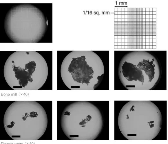 Fig. 7. Measurement of the particle sizes (The black bar indicates 1000㎛). 