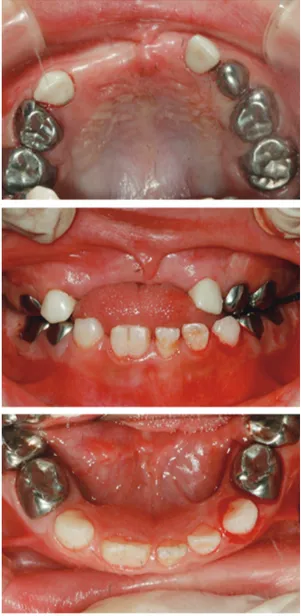 Fig. 3. Intraoral photo after treatment.