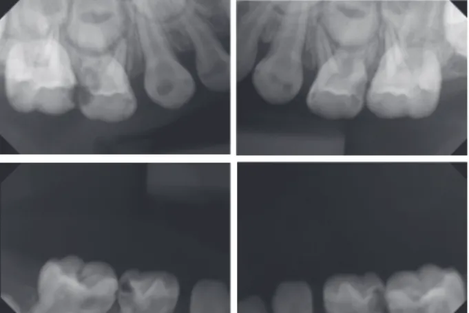Fig. 1. Standard panorama before treatment.