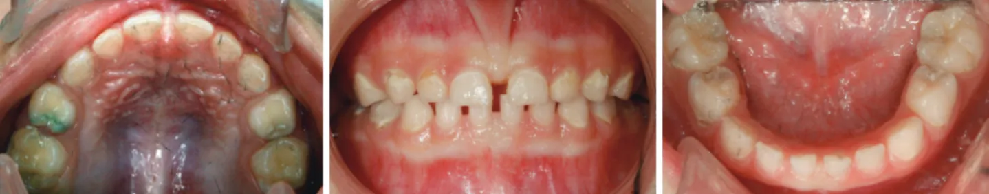 Fig. 4. Intraoral photo before treatment.