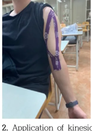 Figure 2. Application of kinesio taping 평가도구 및 측정방법