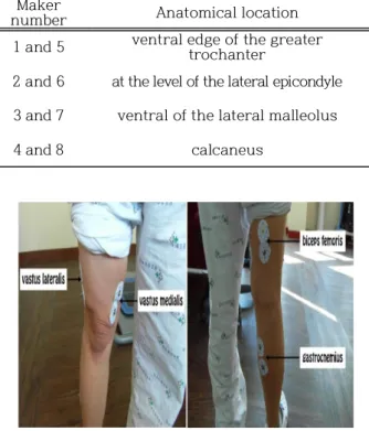 Figure 1. Placement of surface electrodes