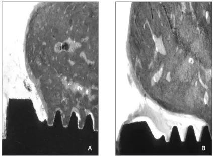 Fig. 6. The ground sections illustrate the result of healing. A, The defect adjacent to coronal portion of US II plus implants is filled with newly formed bone