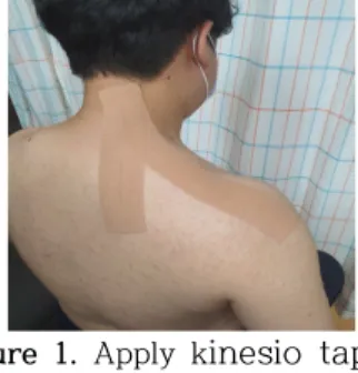 Figure 1. Apply k inesio taping 상지협응 운동의 적용 방법2) 한쪽 상지의 굴곡 내전 외측회전과 견갑골 하각의 외- -측 상방 전방의 움직임을 유도하였고 동시에 반대-측 하--, 지의 굴곡 내전 외측회전과 동측의 좌골결절은 전방 상-- -방 내측 -방향으로 움직임을 유지하면서 반대측 상지의-, 신전 외전 내측회전과 견갑골 하각은 후방 하방 내측의--- -움직임을 유도하였고 동시에 반대측 하지의 신전 외전,-  -내측회전과 동측의 