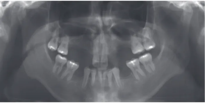 Fig. 1.  Panoramic radiograph. 