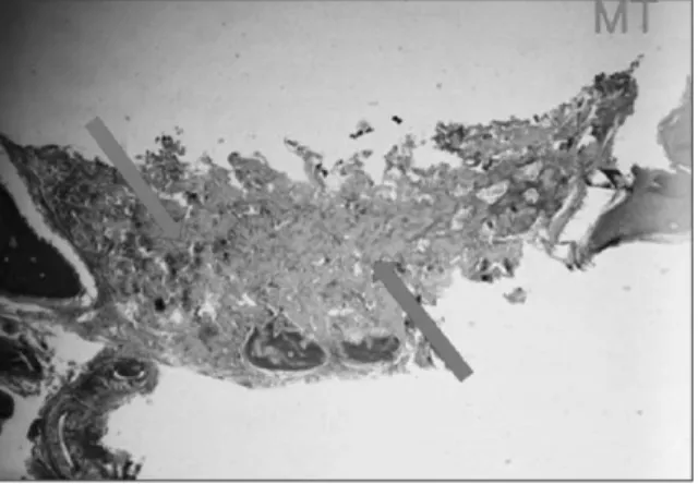 Fig. 11. MT  stain  findings  of  experimental  group  II,  4 weeks (×50).