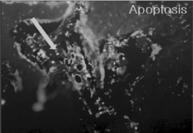 Fig. 14. PCNA,  findings  of  control  group,  4  weeks  (×