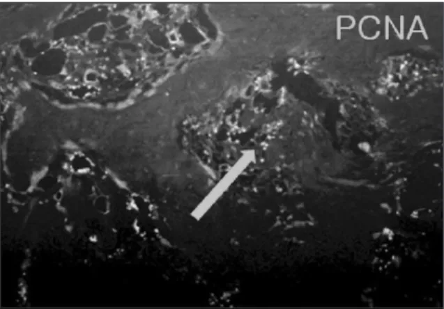 Fig. 17. Apoptosis,  findings  of  experimental  group  I,  4 weeks (×200).