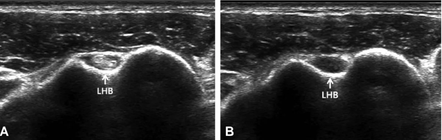 Fig. 2. Short axis image at the insertion of the pectoralis