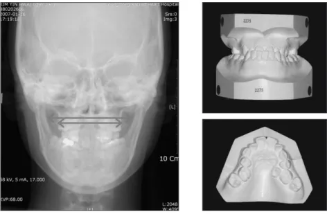 Fig. 3. Initial frontal cepahlogram.