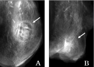 Fig. 3. Radiographs  of  the  B-1  group  at  4  (A) and  8  (B) weeks after the graft