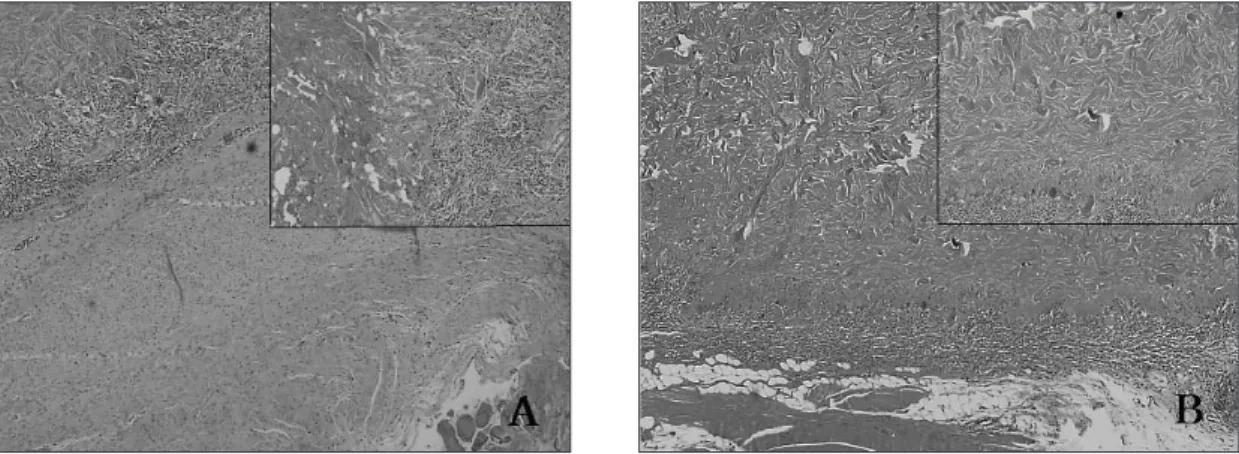 Fig. 9. Photomicrographs of the S-3 group at 4 (A) and 8 (B) weeks after the graft. A, The migration of the fibroblasts into the periphery of collagen fibers is observed (H-E stain, original magnification  × 40 and inset × 100)