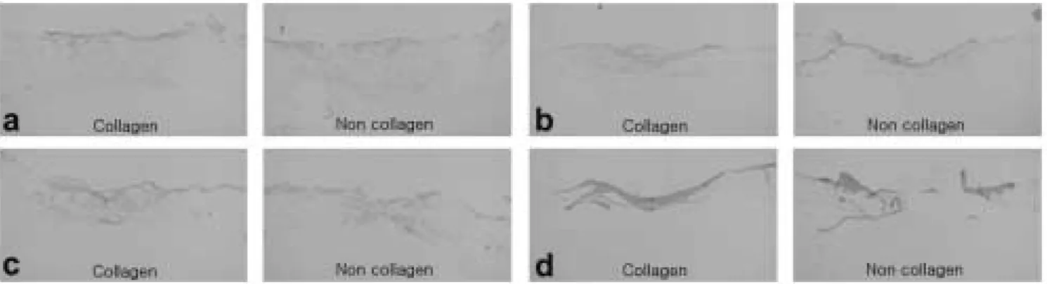 Fig. 10. Immunohistochemical findings, vWF, × 40.
