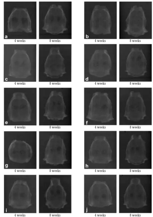 Fig. 5. Radiographic appearance of cranial vault, left 4 weeks, right 8 weeks each.