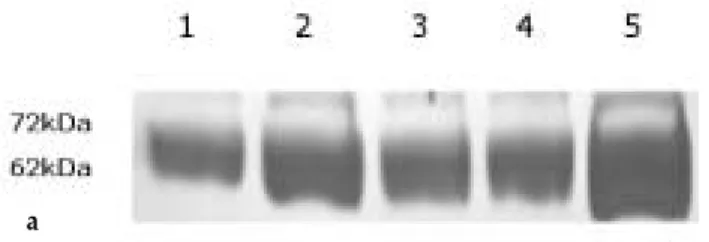 Fig. 1-c. The relative levels of expression of survivin and gelatinolytic activity in each cell line