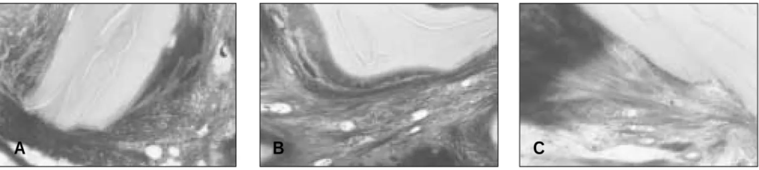 Fig. 6. Photomicrograph illustrating grafting area 8 weeks after surgery. 