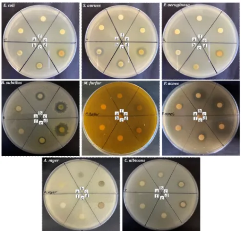 Fig.  4.  Anti-microbial  activity  of  ES  and  EEA,  EBuOH,  ECHCl 3 ,  EDW  and  EHex