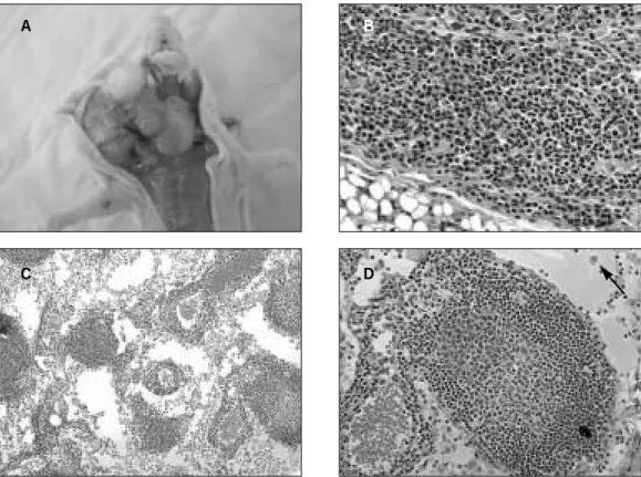 Fig. 5. Gross and histologic features of cervical lymph nodes of a tumor-bearing mouse.