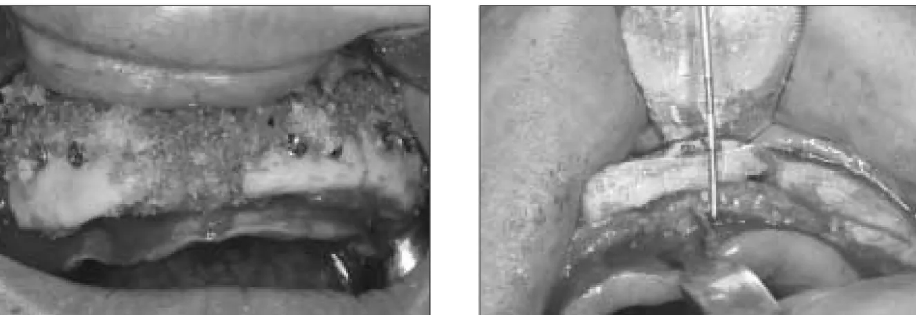 Fig. 7. Postoperative panoramic view.