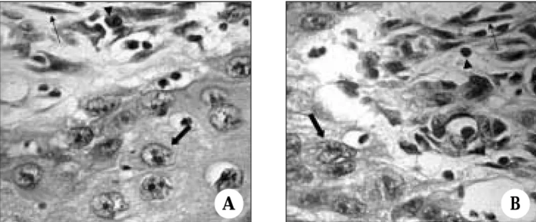 Fig. 2. Representative photomicrographs of staining for vascular endothelial growth factor receptor-1 (VEGFR-1) in biopsy (A) and radical excision specimen (B)